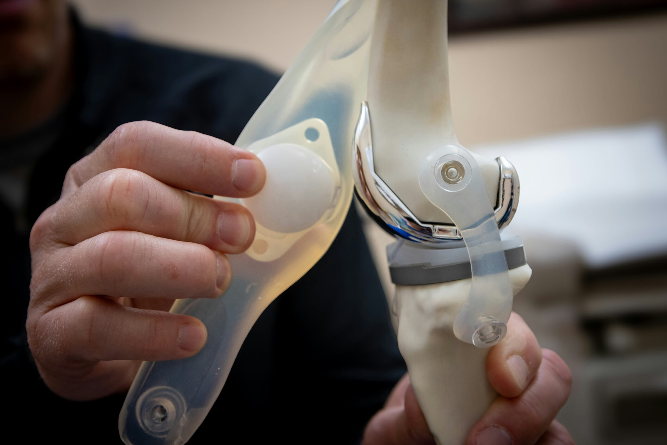 Knee Replacement Surgery: Who Needs It and What to Expect